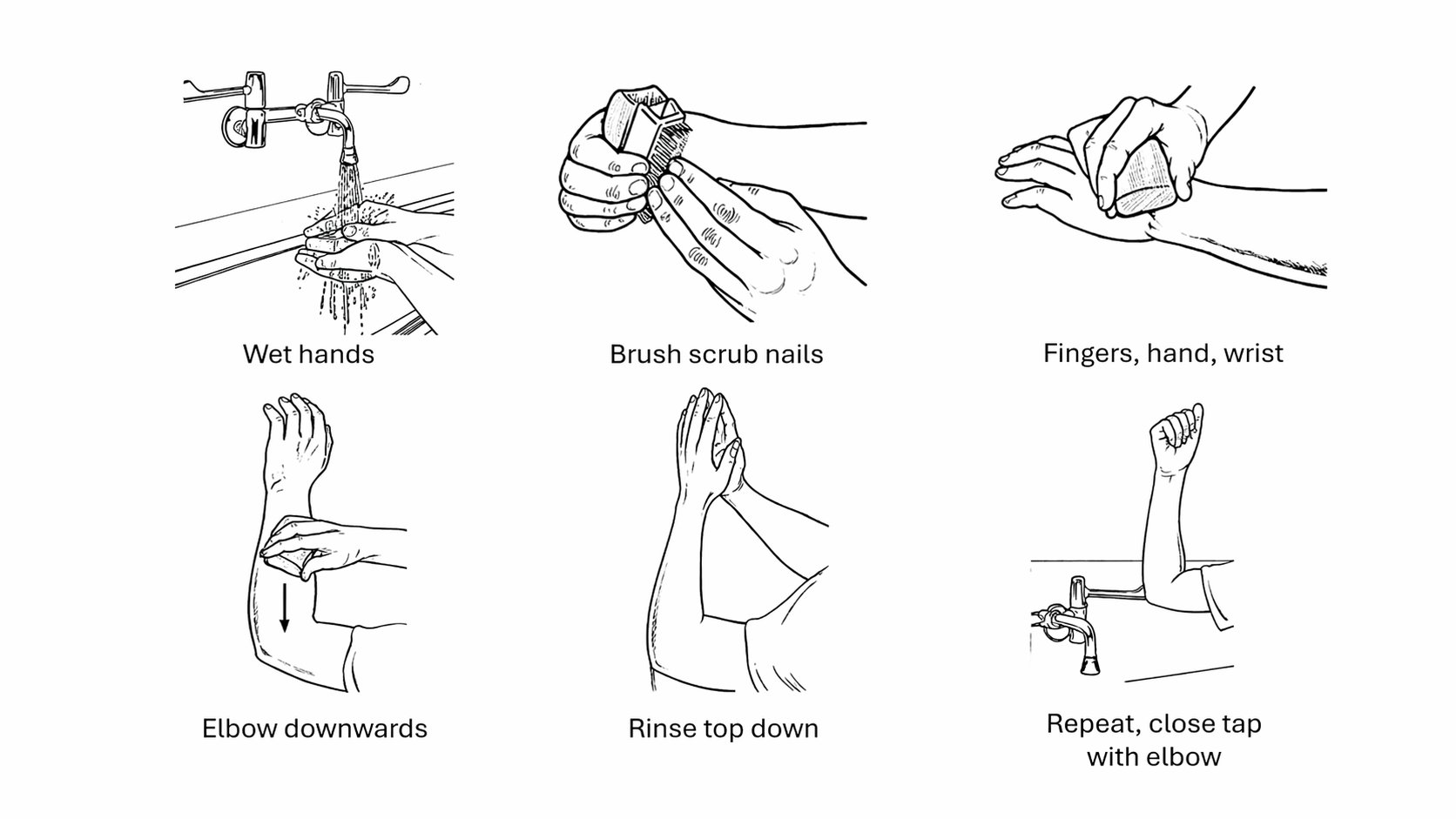 Six-panel illustration of surgical scrubbing technique: wetting hands, brushing nails, scrubbing fingers and wrist, elbow downward position, rinsing top-down, and closing tap with elbow.